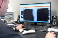 «РТК Радиология» разработала решение для планирования операций по замене тазобедренного и коленного суставов